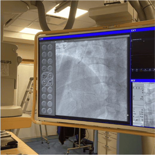 Hemodynamic